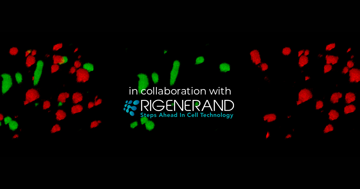 Anti-Cancer Therapy Effect