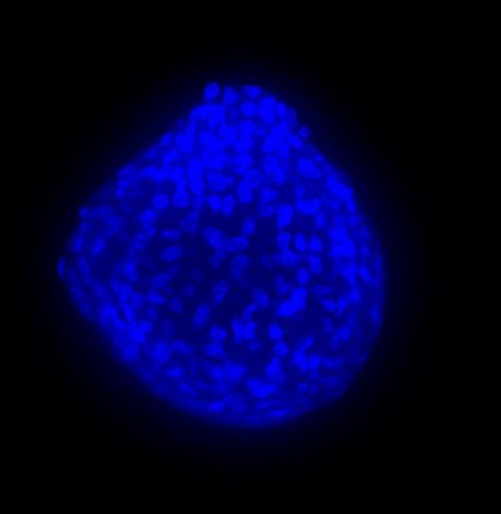 3D tumor spheroids 2
