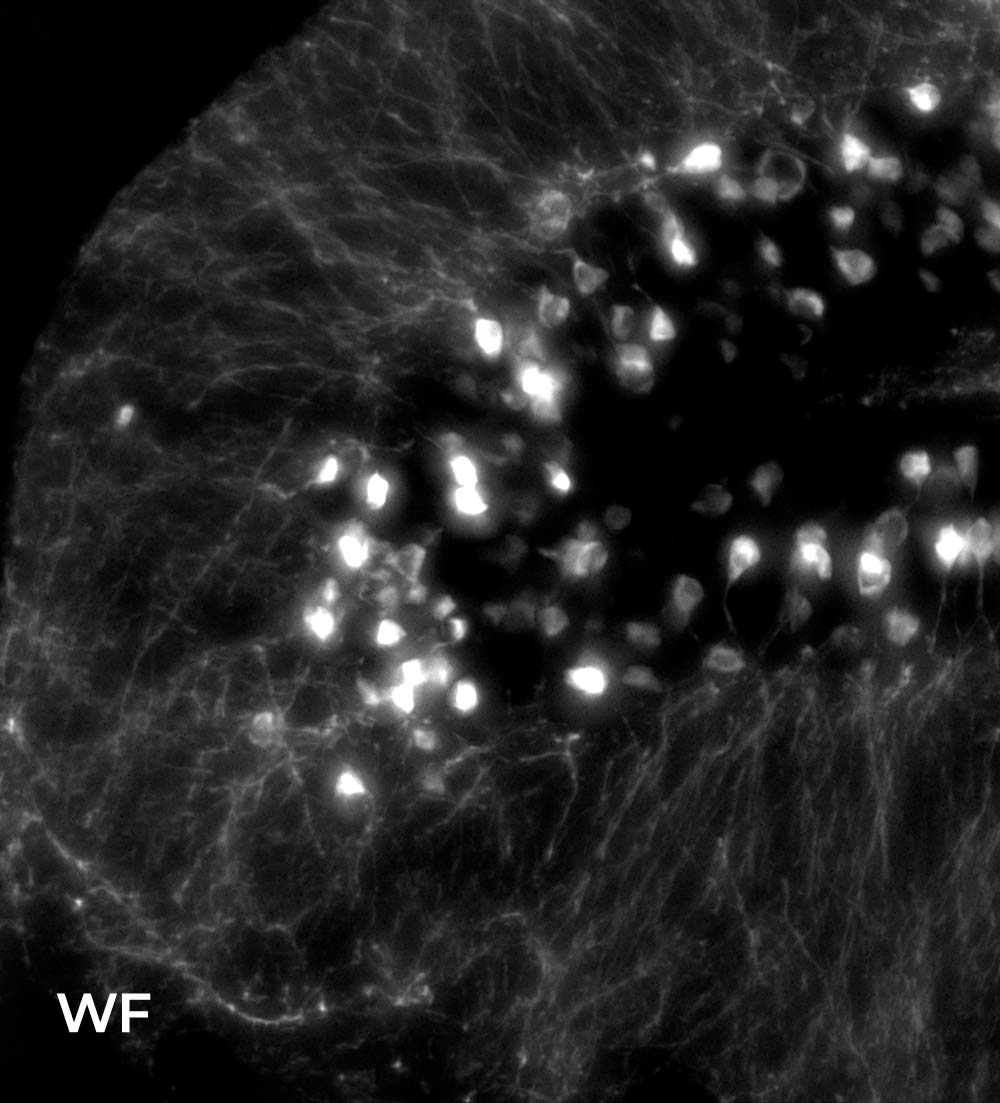 Illumination microscopy 3