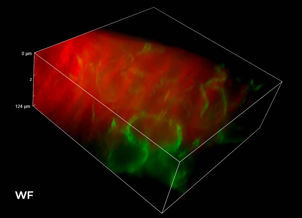 Illumination microscopy