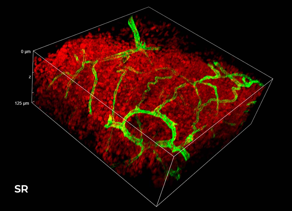 Illumination microscopy 2