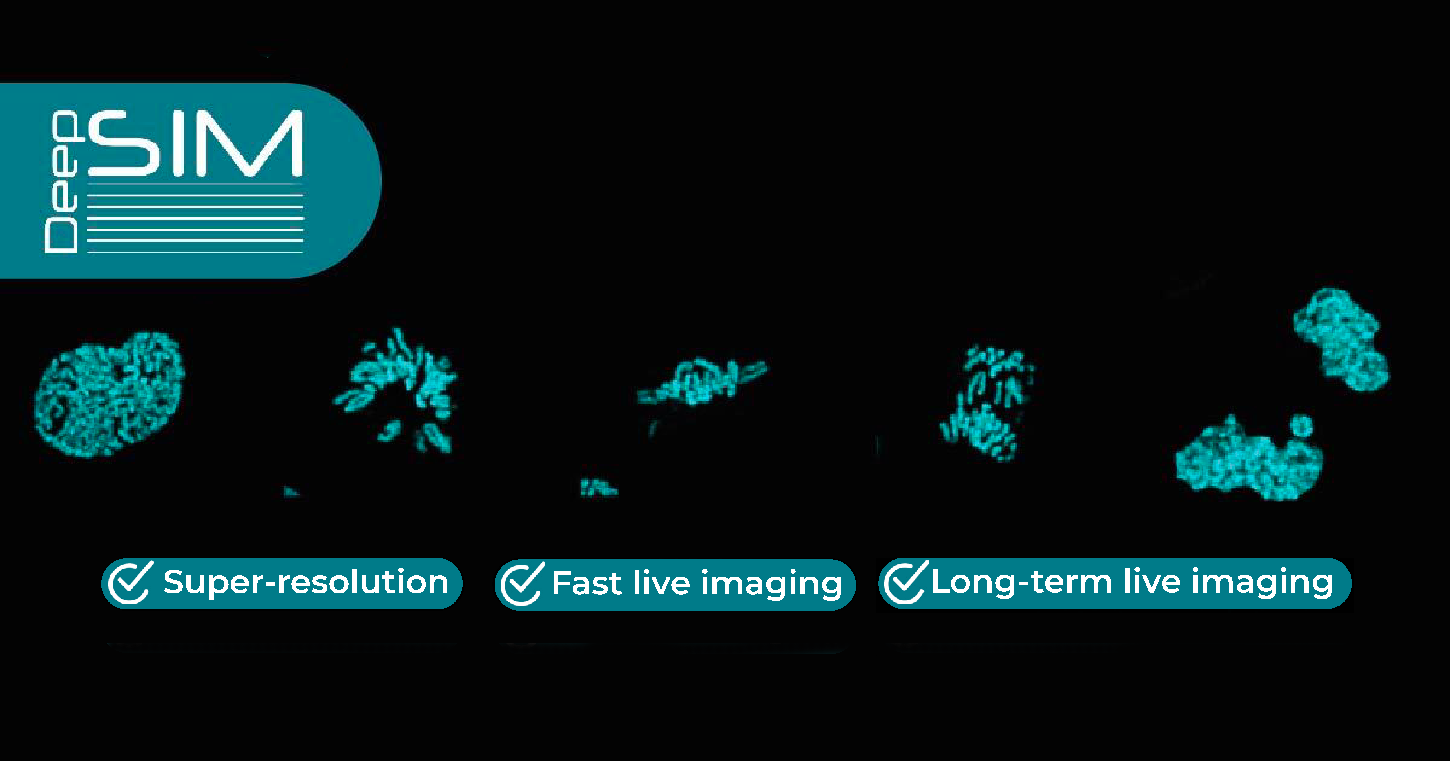 structured illumination microscopy image