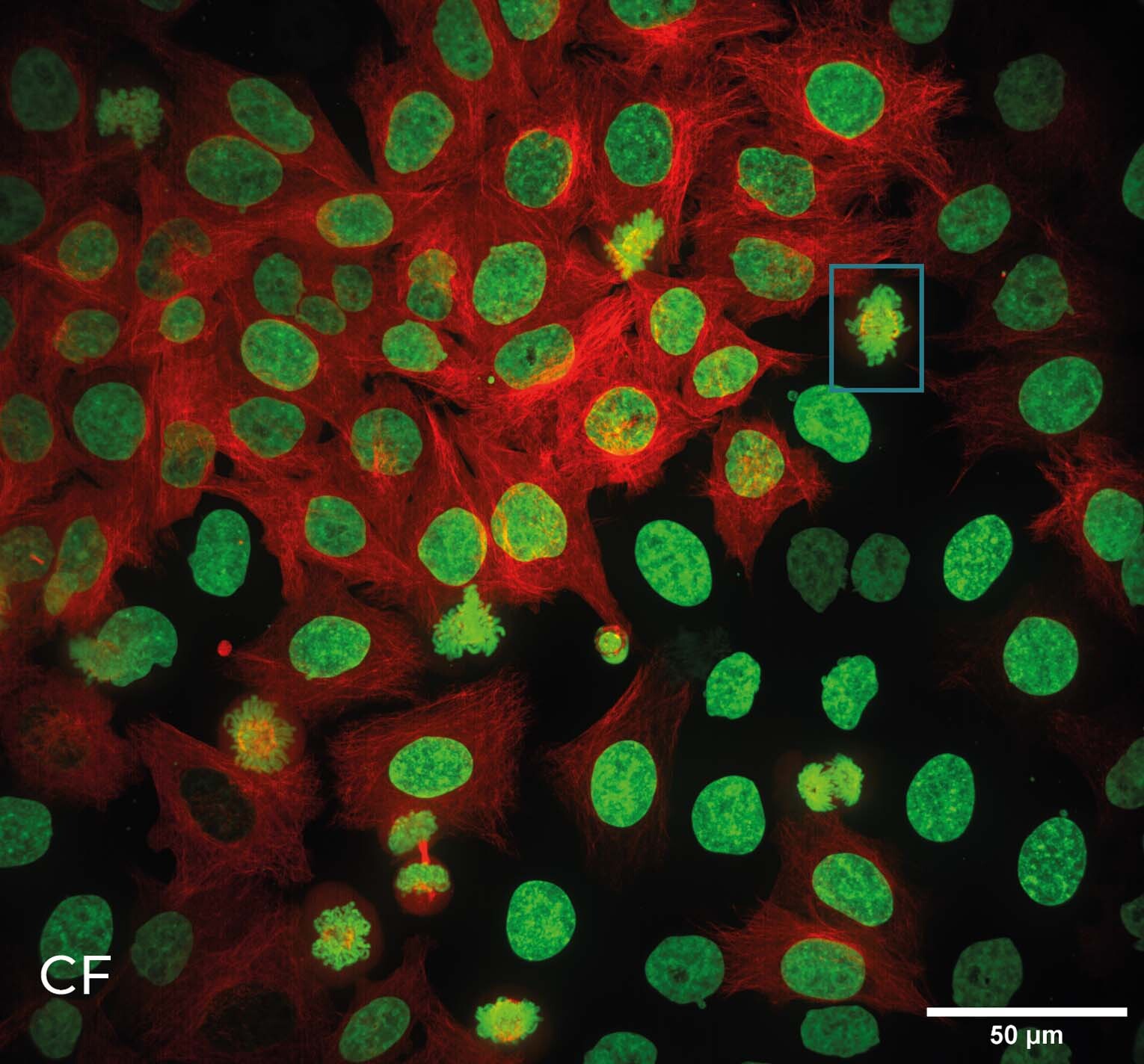 structured illumination microscopy 1