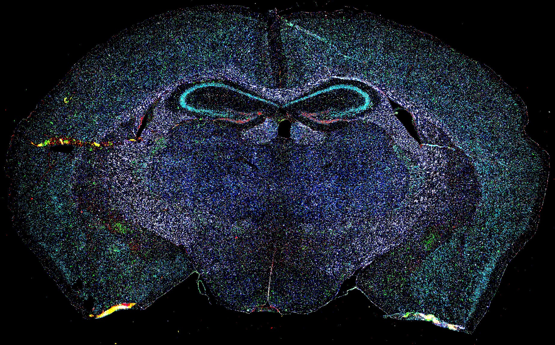 spatial transcriptomics 2