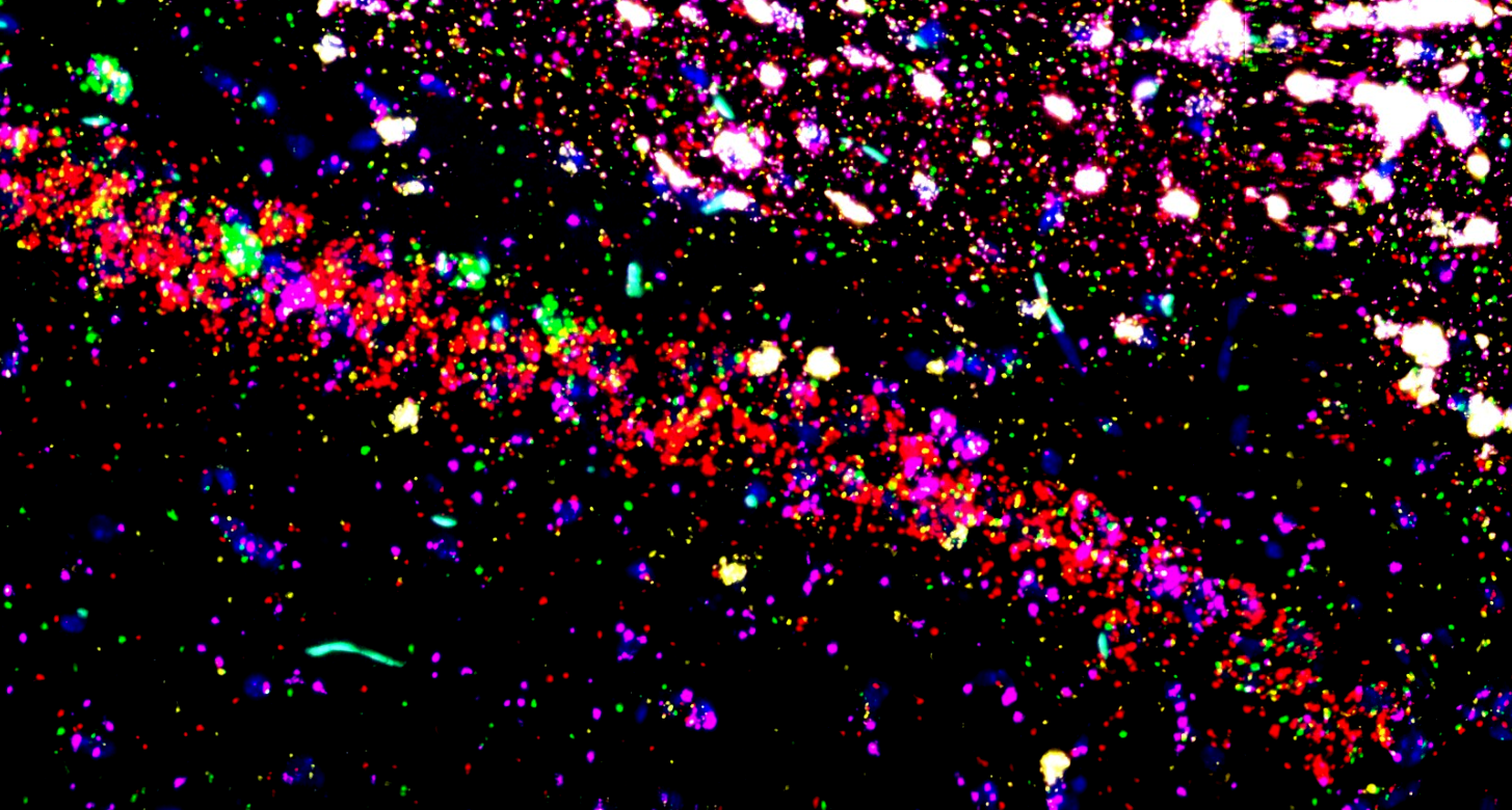 spatial transcriptomics 3