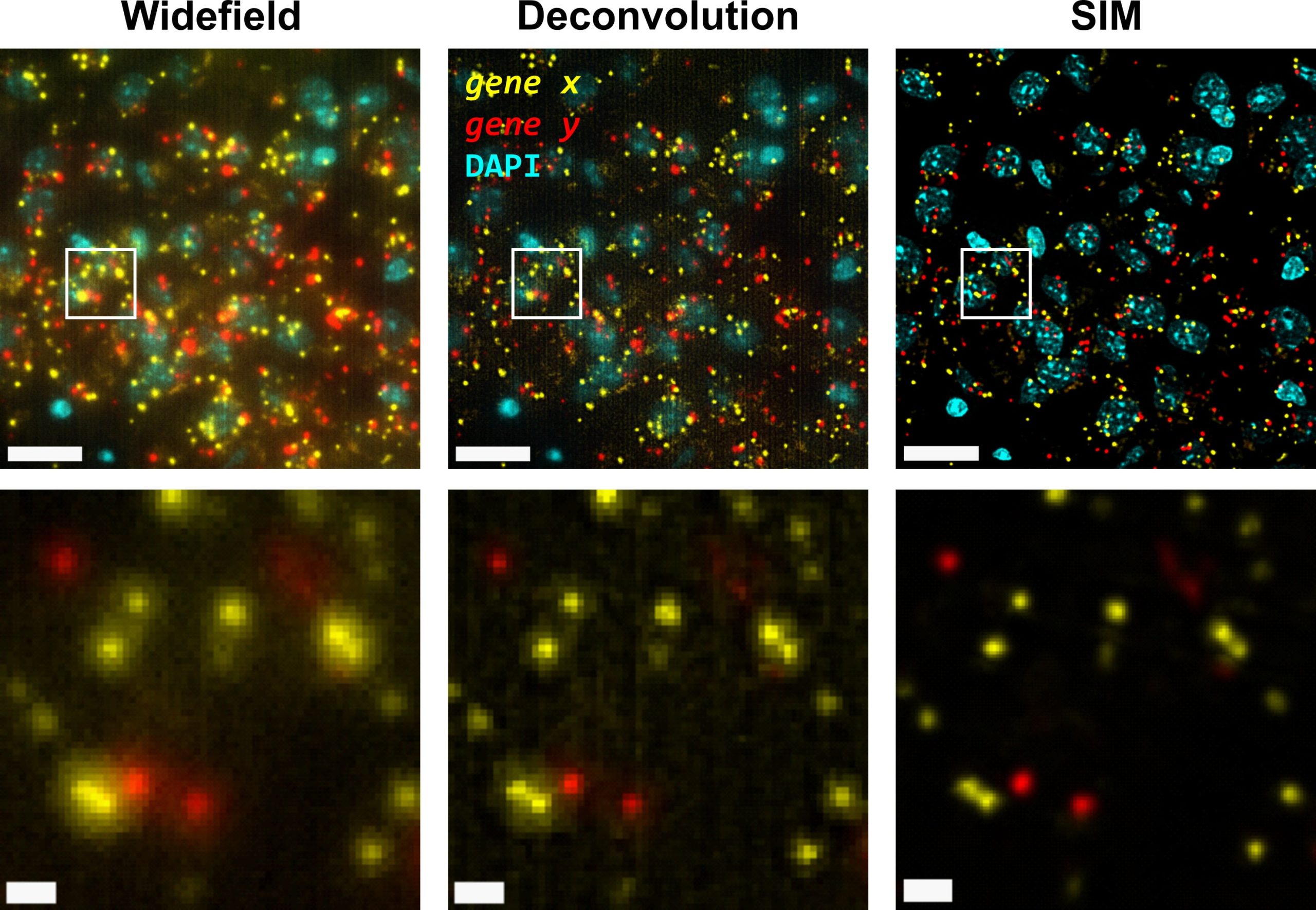 Super-Resolution microscopy