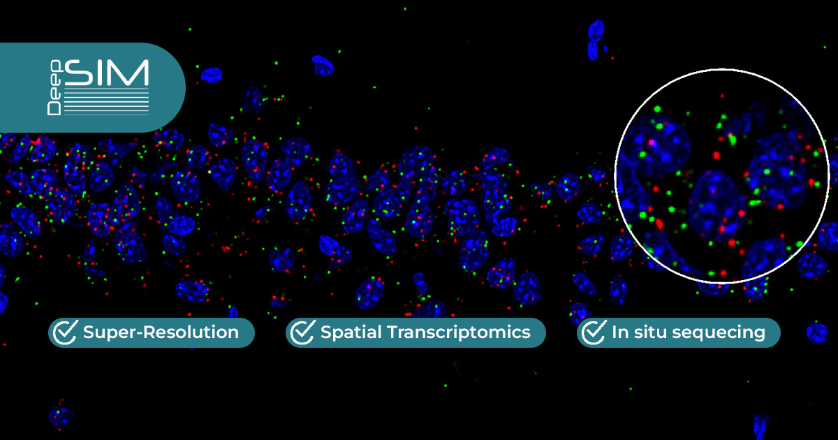 super-resolution microscopy
