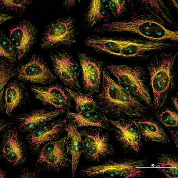 HeLa cells. Multichannel acquisition of subcellular structures. 60x Oil.
