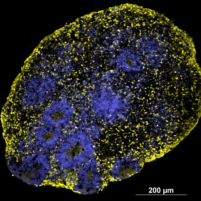 Cortical organoid. Neural differentiation marker and DNA staining. Single FOV of 22 mm. 20x Dry.