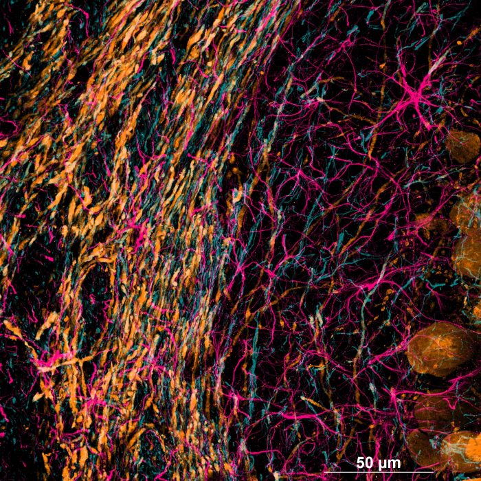 Neurons and astrocytes in rat brain tissue. Multichannel and Z stack acquisition. 60x Oil.