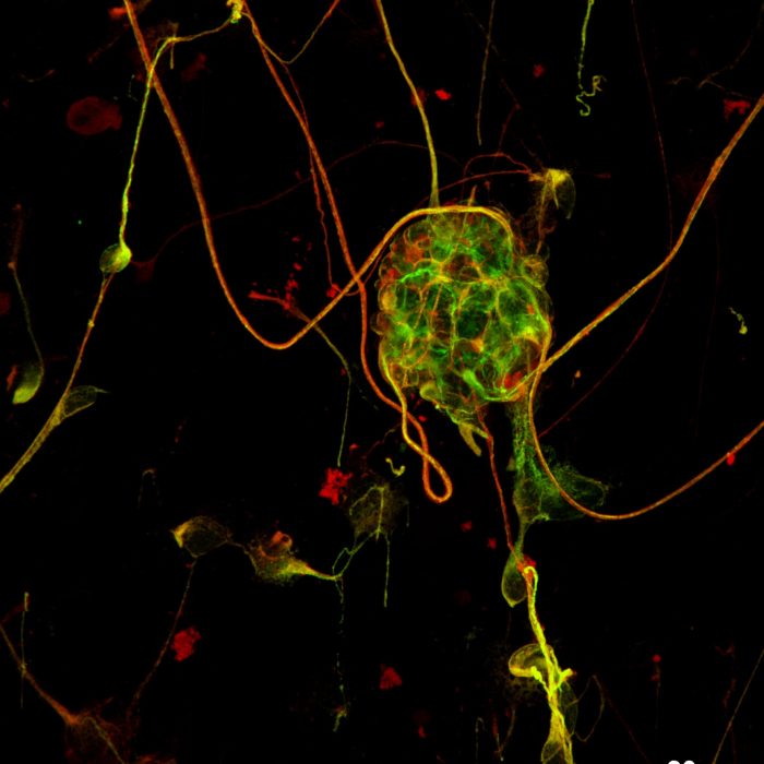 Retinal ganglion cells. Cytoskeletal markers. 60x Oil.
