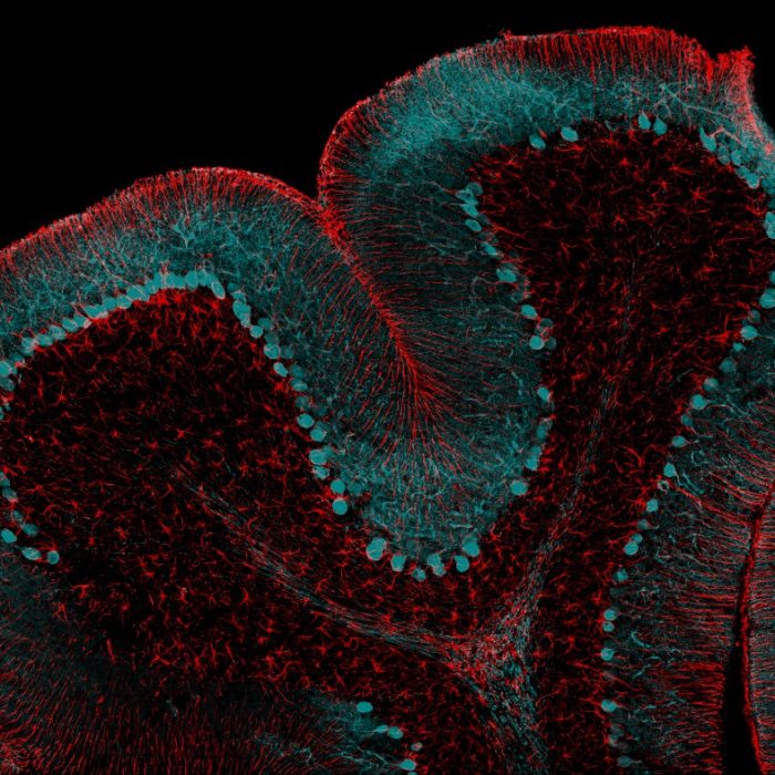 Neurons and astrocytes in rat brain tissue. 20x Dry.